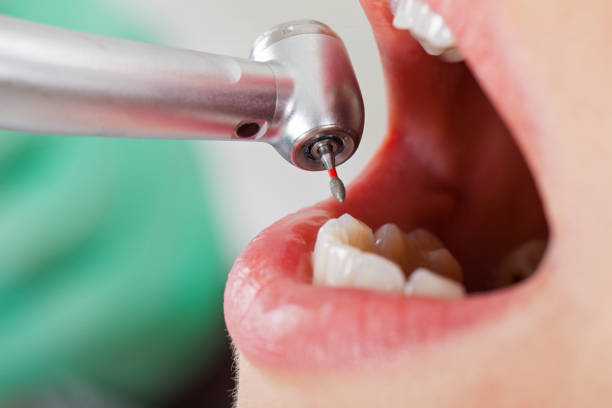 Best Pediatric Emergency Dentist in Rialto, CA